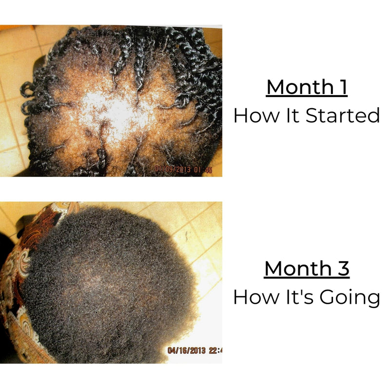 Hair Growth Treatment - Sayblee Products