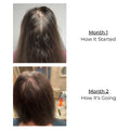 Hair Growth Treatment