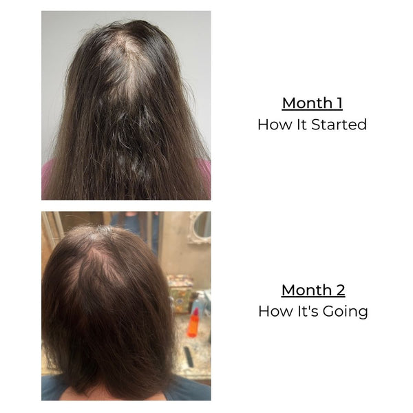 Hair Growth Treatment - Sayblee Products