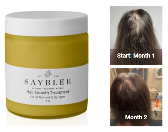 Sayblee Hair Growth Treatment Before and After 2 Months